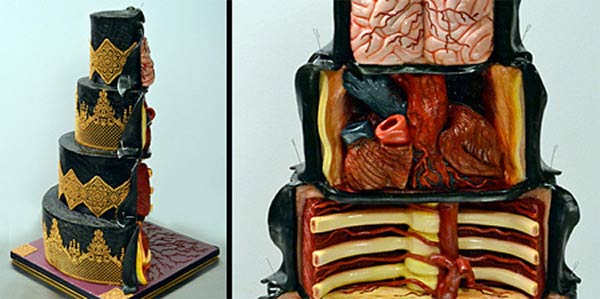 Dissected Cake