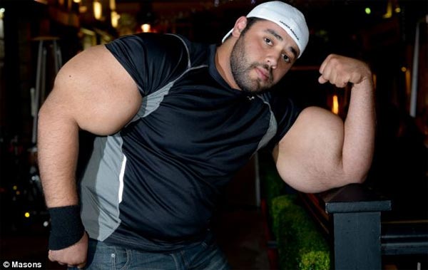 Real-Life Popeye with World's Largest Biceps