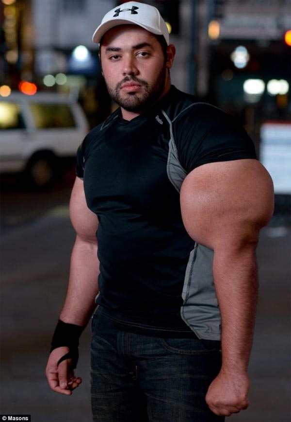 World's Largest Biceps