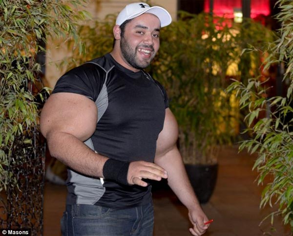 World's Largest Biceps