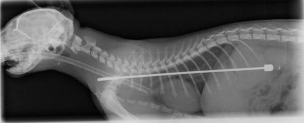 Kitten Swallowed Six-inch TV Aerial