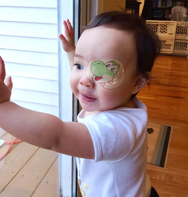 Father Makes Creative Eyepatch For His Daughter