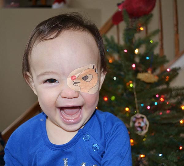 Father Makes Creative Eyepatch For His Daughter