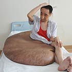 World's Largest Tumor